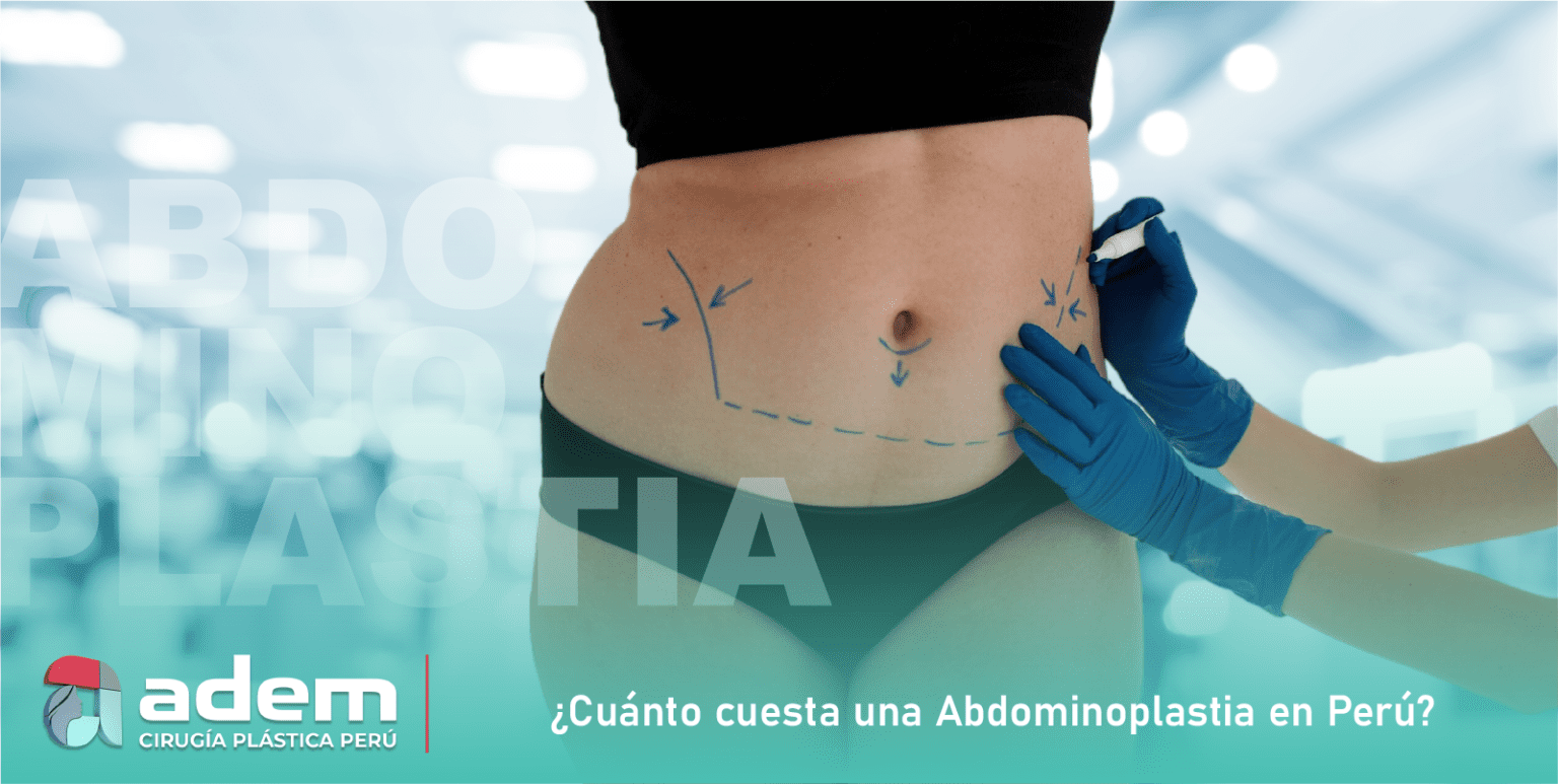 Cuánto cuesta una ABDOMINOPLASTIA en Perú ADEM CIRUGÍA PLÁSTICA_0