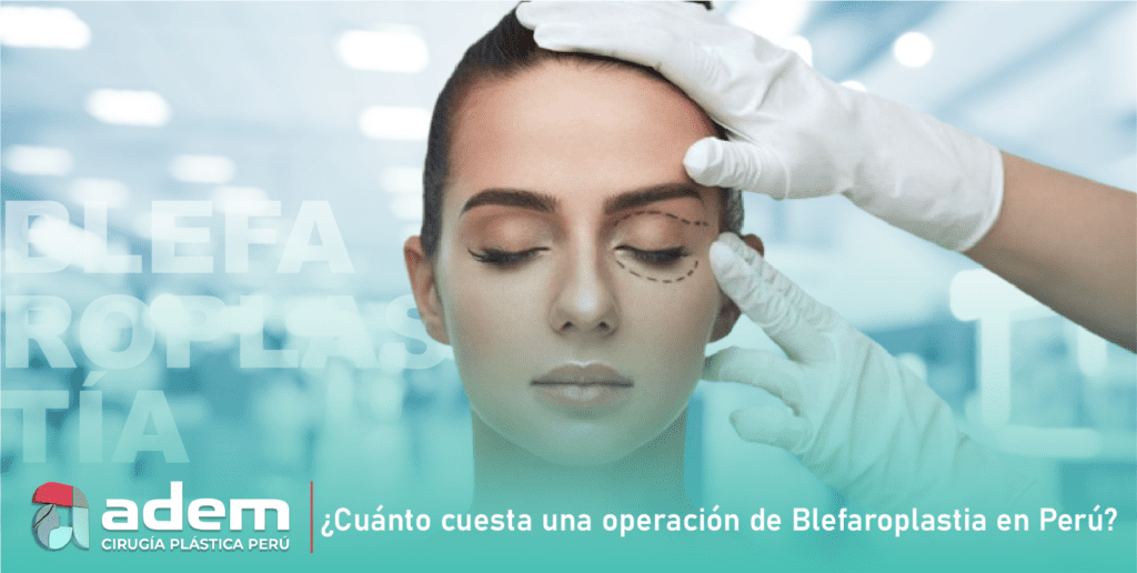 Cuánto cuesta una BLEFAROPLASTIA en Perú ADEM CIRUGÍA PLÁSTICA_0