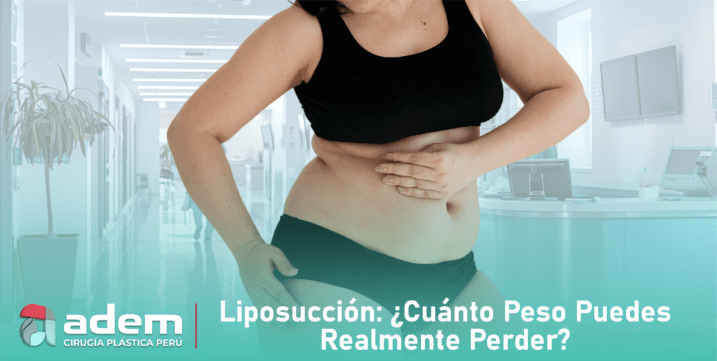 Cuanto peso se puede perder con una liposucción ADEM CIRUGÍA PLÁSTICA_