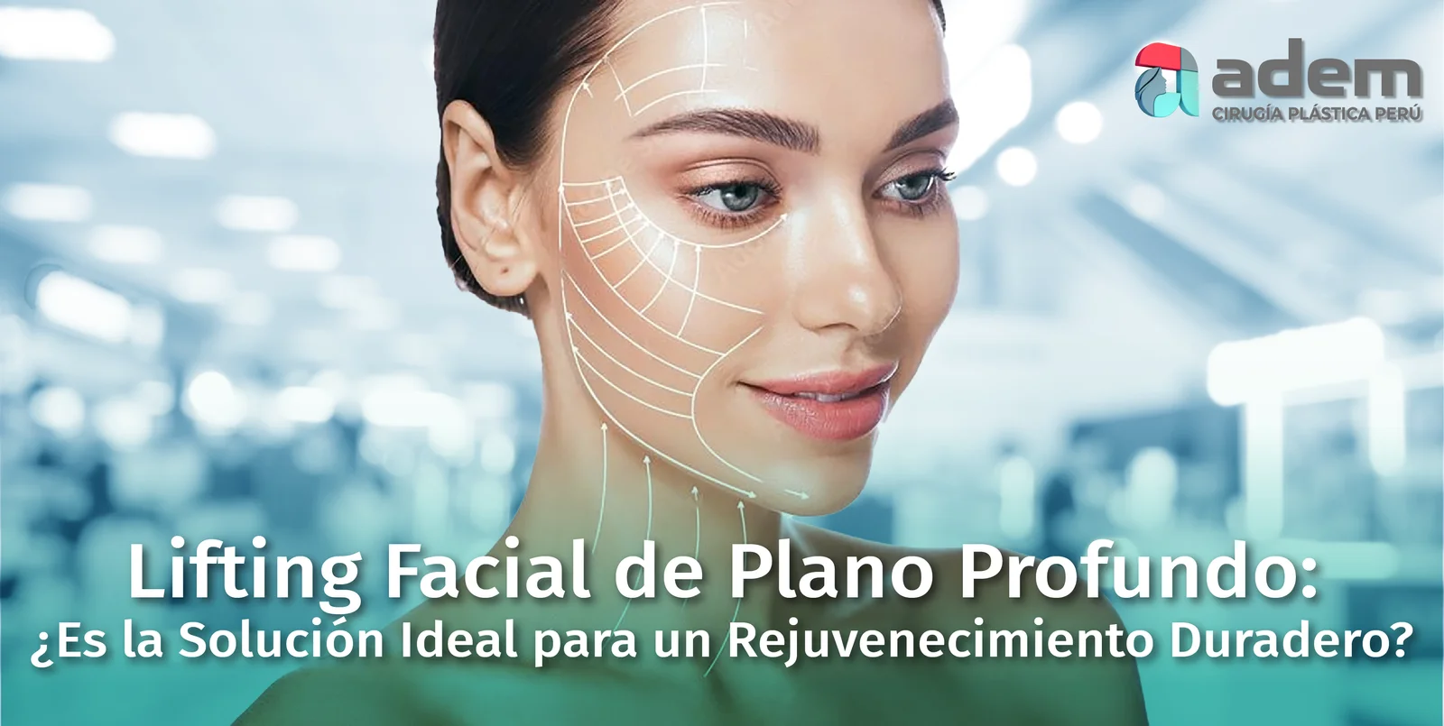 Lifting Facial de Plano Profundo: ¿Solución para un rejuvenecimiento duradero?