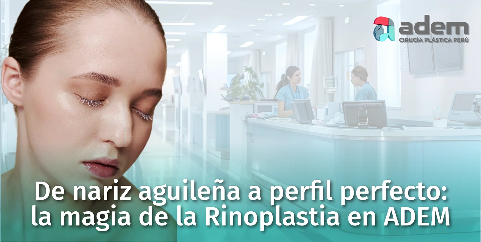 ¿Nariz Aguileña? Resuélvelo con una rinoplastia | ADEM Cirugía Plástica ...