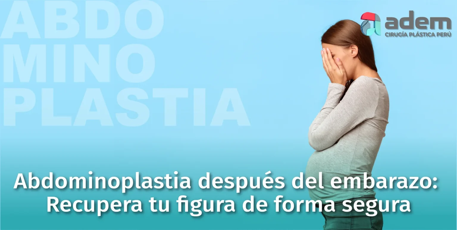 ABDOMINOPLASTIA-DESPUES-DEL-EMBARAZO-en-Peru-ADEM-CIRUGIA-PLASTICA_Mesa-de-trabajo-1-1