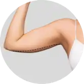 Braquiplastia ADEM