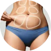 Liposuccion ADEM