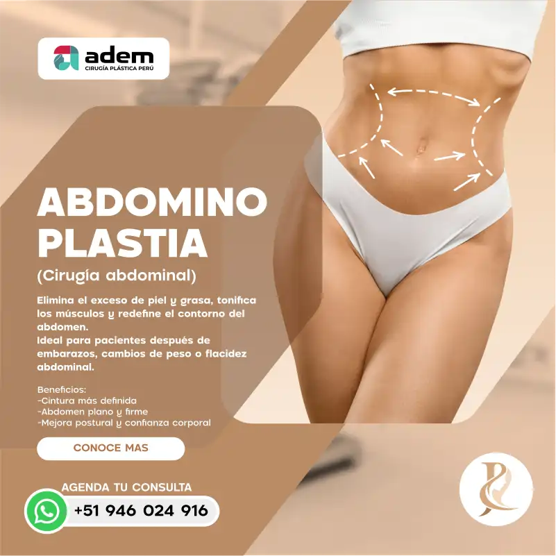 dra rueda - abdominoplastia1