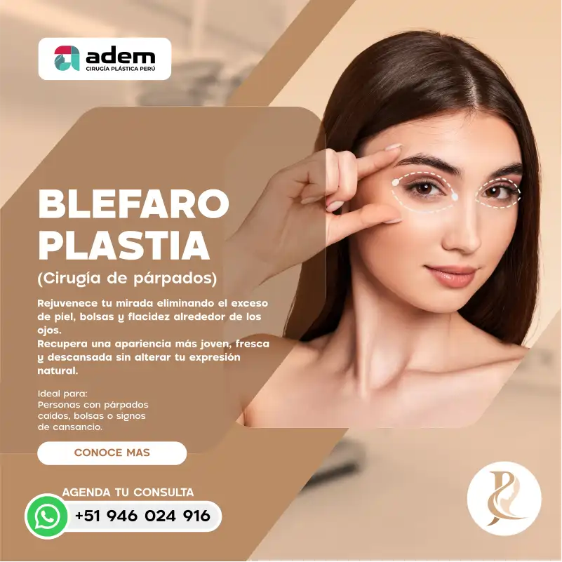 dra rueda - blefaroplastia