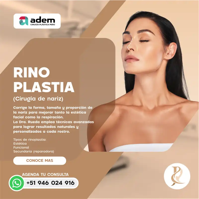 dra rueda - rinoplastia1